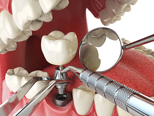 Best Emergency Dental Services for Seniors in Dillon, MT